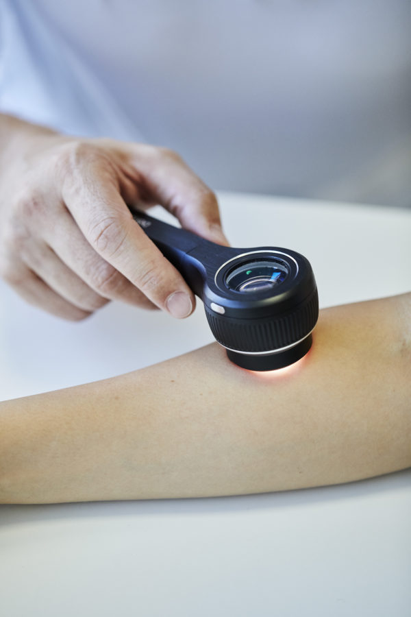 Dermateam Winterthur, Dermtaoskopie Hautarzt Winterthur 2