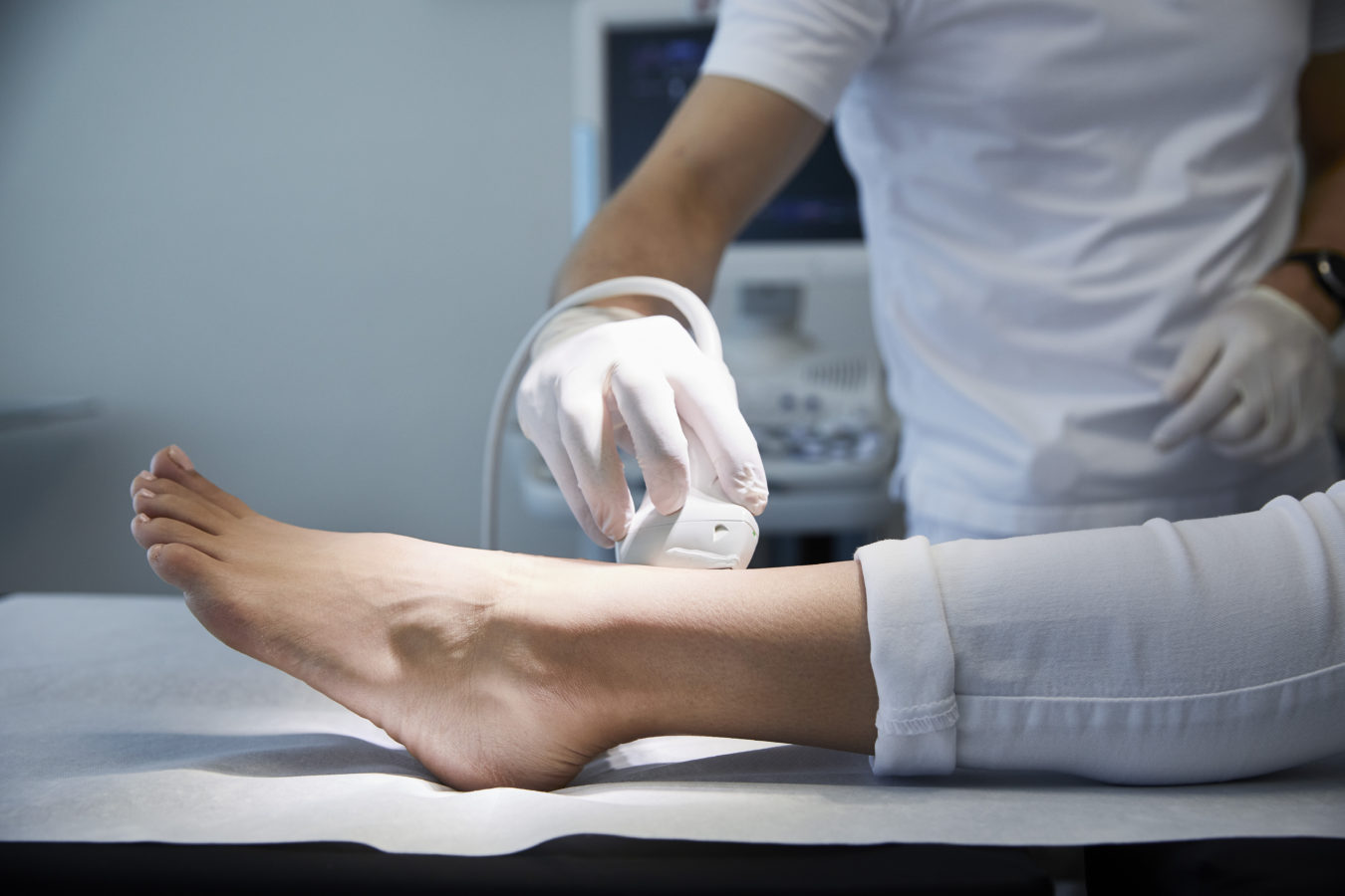 Dermateam Winterthur, Duplexsonographie Venen Bein Winterthur2